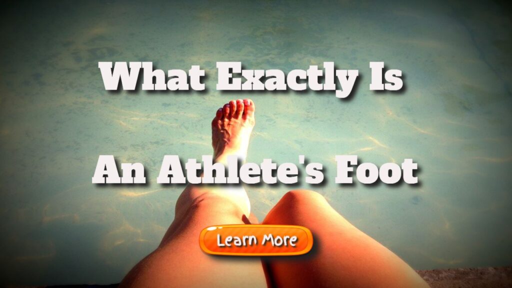 what exactly is an athletes foot